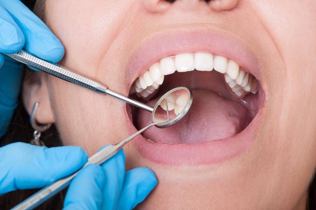 Top 3 Reasons See Your Dentist Regularly